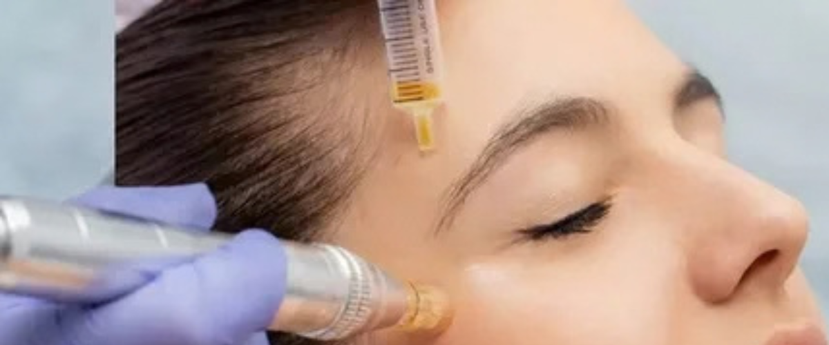 Hair Filler Treatment in Mumbai by Dr. Gunjan Gangaraju