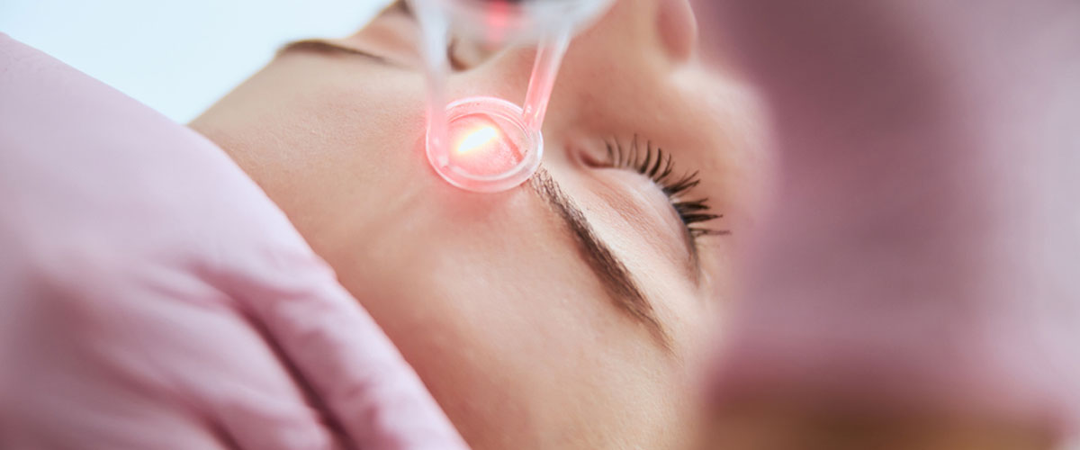 CO2 Fractional Laser treatment in kharghar, Navi Mumbai by Dr. Gunjan Gangaraju