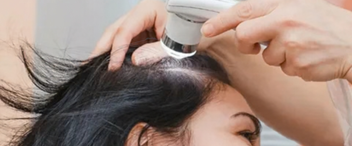 Hair Exosome Treatment in Mumbai by Dr. Gunjan Gangaraju